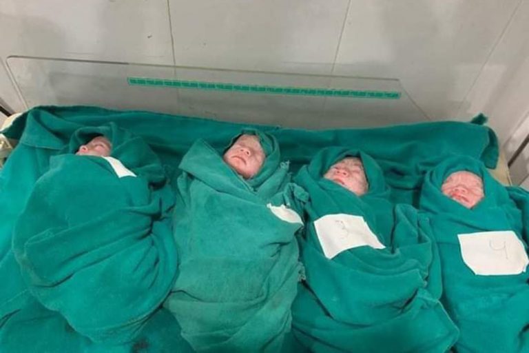 रुपन्देहीकी २४ वर्षीया महिलाले जन्माइन् चम्ल्याहा बच्चा